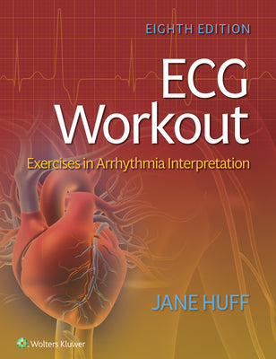 Book cover for ECG Workout: Exercises in Arrhythmia Interpretation