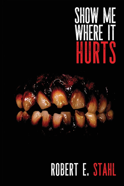 Book cover for Show Me Where It Hurts